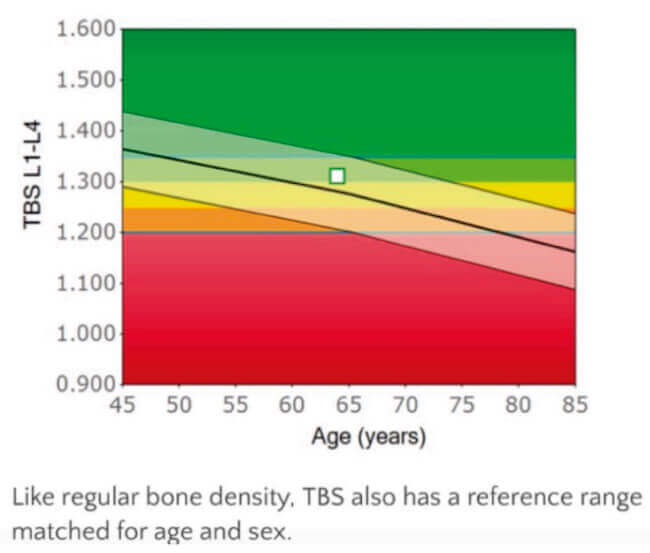 Gráfica de referencia TBS según edad y sexo